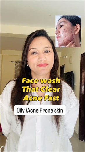 Best Face Wash for Acne & Oily Skin | Dermatologist Picks