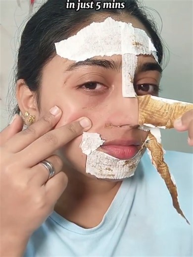 Remove Blackheads & Whiteheads Fast with Coffee Gelatin Mask
