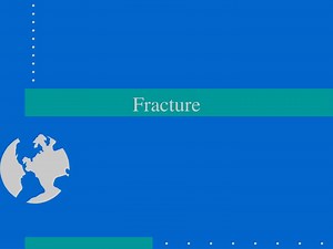 Fracture - SlideServe
