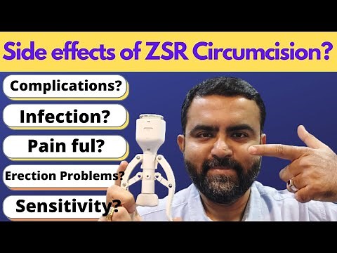 ZSR Circumcision | Side Effects | Problems | Issues | Sensitivity Loss | PainFul? See Details Now !