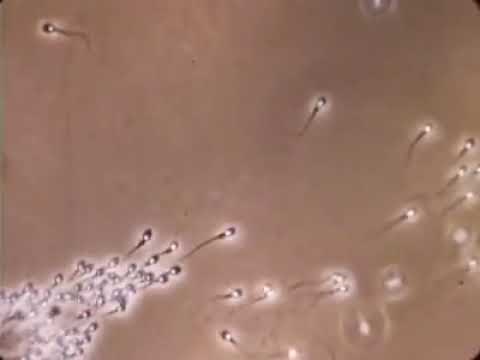 Spermatozoïdes humain observés au microscope optique.