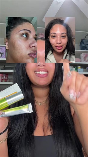 don’t underestimate retinal 😳 it’s probably the truest anti-aging product you can find!! @celimax US Store #celimax #vitaaretinolserum #retinalshottighteningbooster #antiaging #tiktokshopcreatorpicks