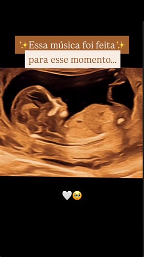 Dra Pollyana Prates | Ultrasom para grávidas on Instagram: "A espera vai ganhando sentimentos, emoções, canções… O coração transborda É lindo de viver ! Se te tocou Compartilhe para aquecer mais corações 💕 Beijo 😘 Polly Dra Pollyana Prates Obstetra, especialista em ultrassonografia fetal CRM 39089 RQE 15080 e 41299 Certificada Fetal Medicine Foundation de Londres ID 121663 Premiada por excelência em Ultrasom fetal no Latin American Quality Award 2025 Escritora sobre maternidade Mentora de médi