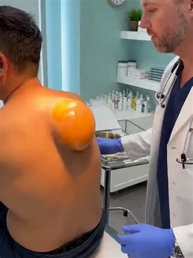 Effective Treatments for Body Acne: A Comprehensive Guide