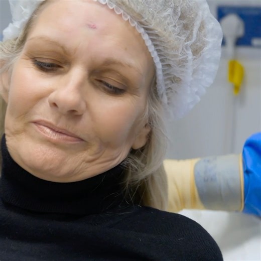Dr Emma removes 37-year-old "horns" from a woman's head 😳 #BadSkinClinic | Love Medical