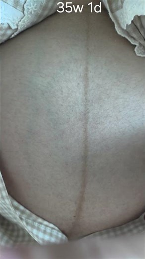 35 week baby movements #baby #pregnant