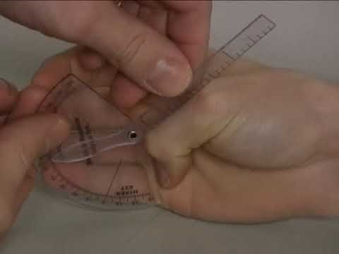 AROM Thumb Interphalangeal (IP) Joint Extension to Flexion