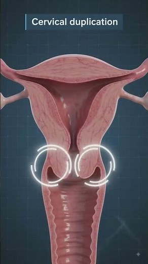 Female Reproductive Tract Anomalies Explained in 3D | Congenital Uterine & Vaginal Anomalies