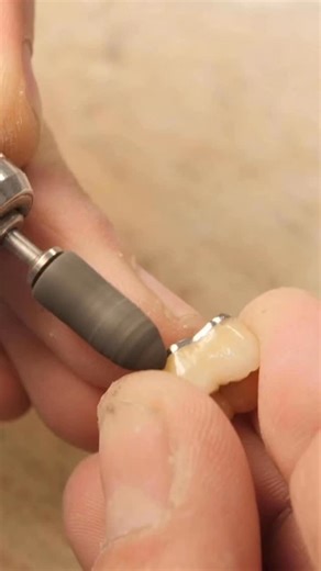 Prothésiste dentaire (H/F) : un métier très recherché ! 📣 Les missions ? Concevoir, fabriquer et ajuster les prothèses dentaires prescrites par les chirurgiens-dentistes. Un savoir-faire technique, au service du confort et du sourire des patients. 💬 « Les qualités premières pour être un bon prothésiste dentaire : la patience et la minutie. » Découvrez le témoignage de Bertrand, Prothésiste dentaire, à retrouver en intégralité sur notre chaîne YouTube. 📽️ | France Travail
