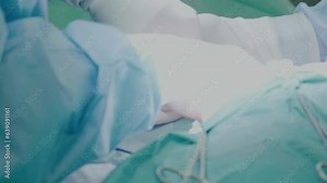 Doctors operate on a woman with cervical cancer on the operating table. Stock Video