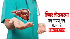 Hepatic Cysts: लिवर में समस्या का कारण बन सकता है हेपेटिक सिस्ट, जानें इसके कारण और इलाज