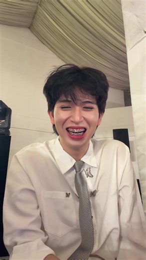 Braces Journey: Transformation and Reveal Process