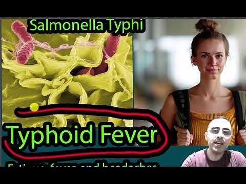Typhoid Fever: Symptoms, Causes and treatment