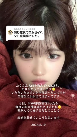 @@@@に返信 聴力異常なし（難聴ではない） 薬を飲み始め、今日気付いたこと 口をゆすぐ時が一番難しい 低い音より高い音が過剰に聞こえている気がする（食器を洗う時、自分の話し声が大きく聞こえてびっくりする） 昨日に比べて身体が慣れた気がする→目を閉じれる 右目の痙攣、口元の痙攣がある たったいま口元が痒い→唇が痒い→口の中が痒い（アレルギー反応？） 病院では薬で様子見とのことです。 明日は歯医者にいきます🪥