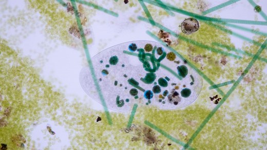 4 Main Groups of Protozoa