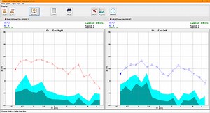 SmartOAE - DPOAE and TEOAE - Intelligent Hearing Systems