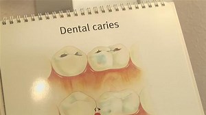 How To Curb Tooth Decay Daily