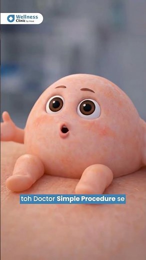 Lipoma Explained: Causes, Symptoms & When to Remove | Don’t Ignore This Lump