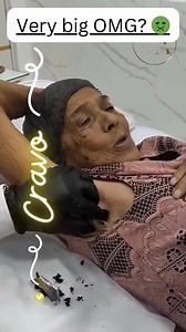 46K views · 229 reactions |  It looked small, but wait till you see the ending! #drpimplepopper #grossaddiction | Pimple Popping | Facebook