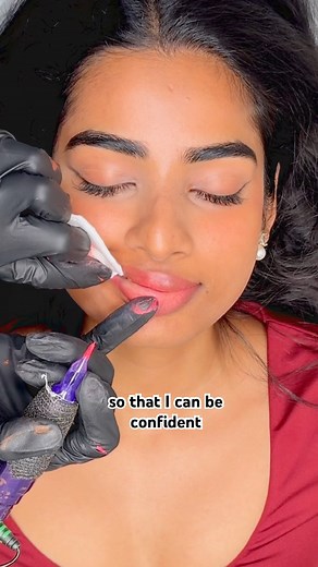 Lip hyperpigmentation removal update. Part 1 #lipneutralization