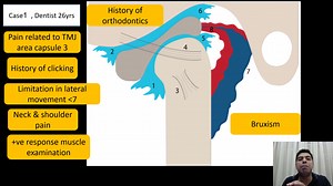 Relationship Between Occlusion & TMD بالنفع 🌹 | Mostafa Mohamed Taha
