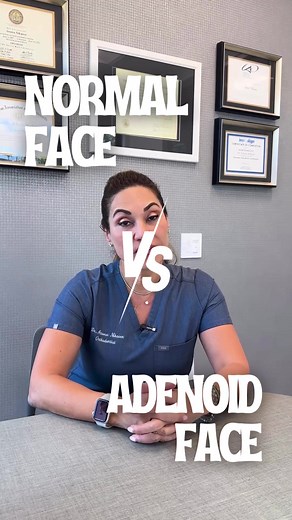 Understanding Adenoid Face: Causes and Solutions