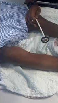 #hyperreflexia upper motor neuron lesion