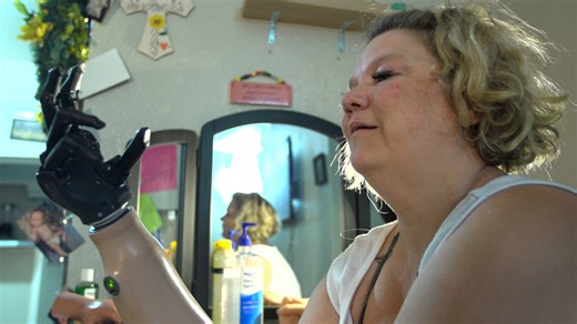 A helping hand: Strangers offer quadruple amputee the gift of hope