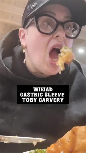 Understanding the Gastric Sleeve Procedure