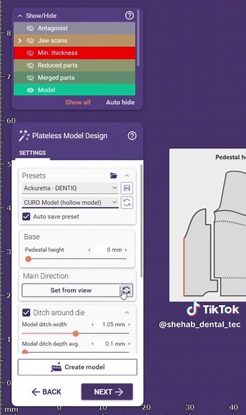 Exocad tips 🤍🤝#dentalstudent #dentist #exocad #dentalschool #dental_technician #explore #viral