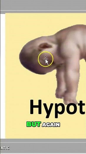 Newborn Hypotonia: Signs & What You Need to Know #shorts
