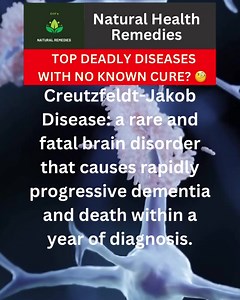 Top deadly diseases with no known cure CJD or Creutzfeldt Jakob...