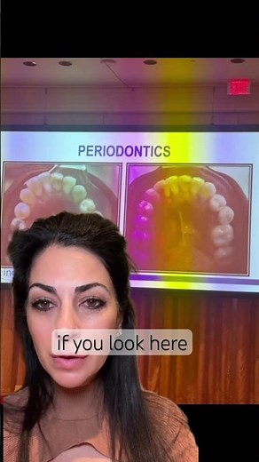 Why you should get Invisalign | Dr. Yazdan Newport Beach Orange County | invisalign before after