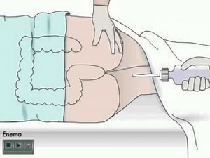 How to give enema