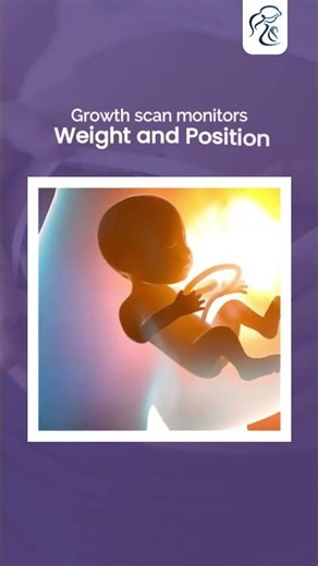 प्रेगनेंसी स्कैन जिन्हें आपको कभी नहीं छोड़ना चाहिए | बेबी हेल्थ गाइड | Dr. Vidushi Mehta