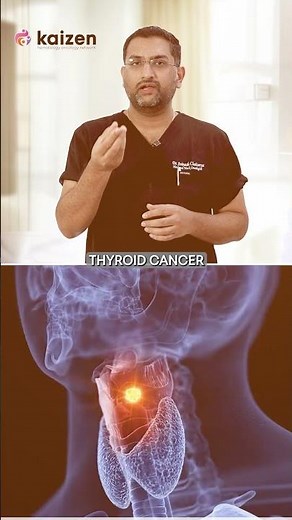 What are the signs of thyroid cancer? | Dr.Avinash Chaitanya | #thyroidcancer #thyroid #cancer