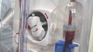 Apheresis machine to extract plasma and platelets from blood. Blood Purification Medical Procedure (Plasmapheresis, Dialysis) with Medical Device in Hospital