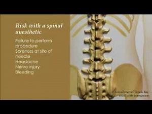 Spinal Anesthesia