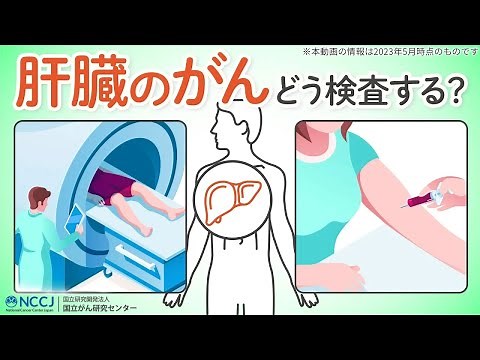 [Testing] How is liver cancer tested? How is the stage determined? We answer your questions about...