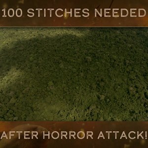 1.1M views · 14K reactions | Jeremy travels to South America's smallest country, Suriname, to talk with the victim of a mysterious attack. #RiverMonsters #Suriname #WolfFish | River Monsters Global | Facebook