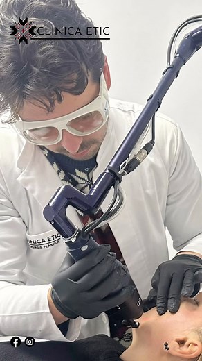 ❗️ Tratamentul cu Laser CO2 ❗️este recunoscut drept cel mai performant tratament – standardul de aur – pentru vaporizarea țesuturilor moi și pentru procedură de „skin resurfacing”. În ceea ce privește modulul chirurgical, acesta are vaste aplicații în tratarea diverselor leziuni. Printre cel mai des întâlnite enumerăm: papiloame, fibroame, veruci, condiloame, angioame, keratoze, siringoame, xantelasme, anumite tipuri de alunițe și altele. ♥️Râmâi cu noi, suntem Alături de VOI 🤍 #eticclinic #con