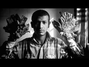 25 EXTREMELY Bizarre Medical DISORDERS