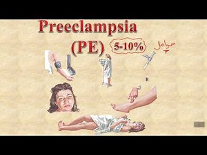 Preeclampsia part 1