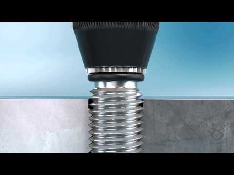 KOBSERT® - insert fileté pour le métal