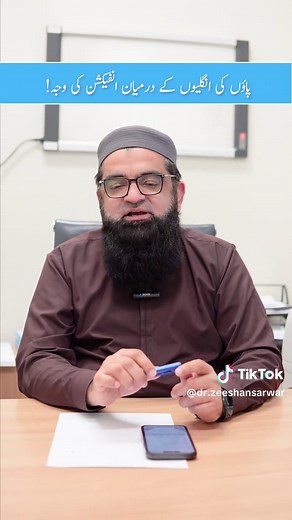 Causes of Fungal Infection Between Toes Explained!