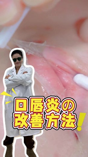 口唇炎に効果的な対処法