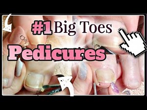 #1 Pedicure Tutorial Compilation: Big Toenail Buildup Cleaning😵✔