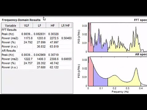 Heart Rate Variability Analysis Using Kubios Software and Excel Template