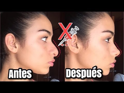 HOW TO HAVE A CUTE AND BEAUTIFUL NOSE IN 5 MINUTES