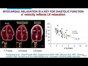 Pericardial Diseases II: Constrictive Pericarditis | Mayo Clinic Echo 2024